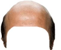 Bald Head Snapchat Filter png transparent